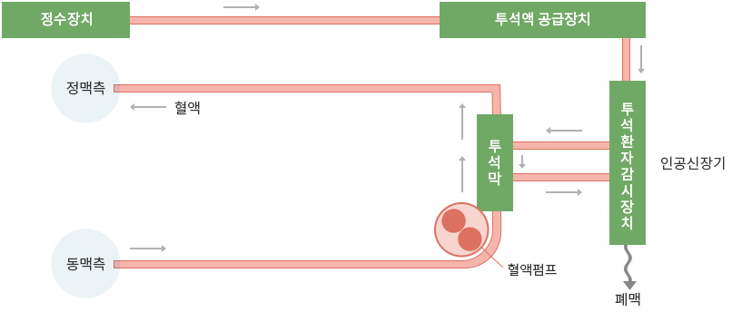 혈액투석 회로