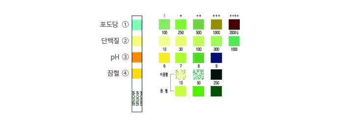 소변스틱결과판독